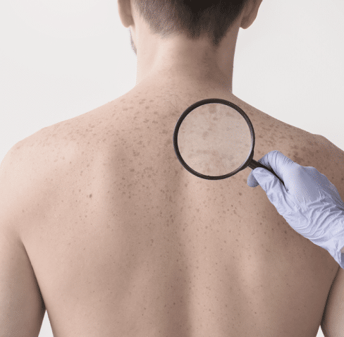 Ricardo Tiussi | Especialista em Câncer de Pele e Cirurgia de Mohs